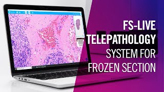 FS-Live Telepathology System for Frozen Section | by Motic Europe screenshot 5
