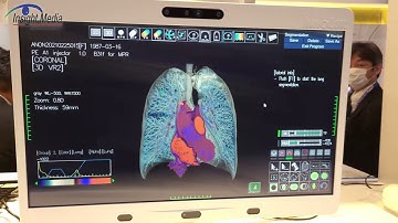 Display Week 2022 - Innolux Debuts Medical 3D Monitor