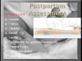 The Post Partum period Chapters 18,19, & 20