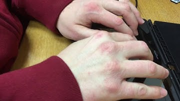 19. Creating a Document with the Braillenote Touch