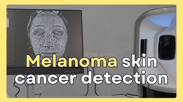 Melanoma skin cancer breakthrough technology for early detection  |  Conquering Skin Cancer