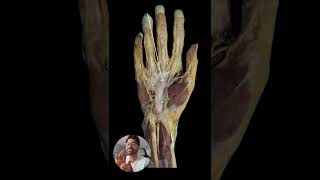 Cadaveric dissection of the hand #medicine #MedSchool #MedStudent #Doctor #Resident #Anatomy #md