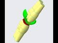 CAD Design of TKR Implant for Total Knee Replacement by Solidworks Biomechanics Biomedical engineer