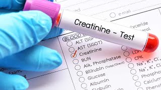 What is Creatinine Blood Test? Normal Range