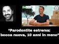 Dr Palmas Opinioni Moldavia: Parodontite Estrema, Bocca Nuova e 10 Anni di Differenza nel Sorriso
