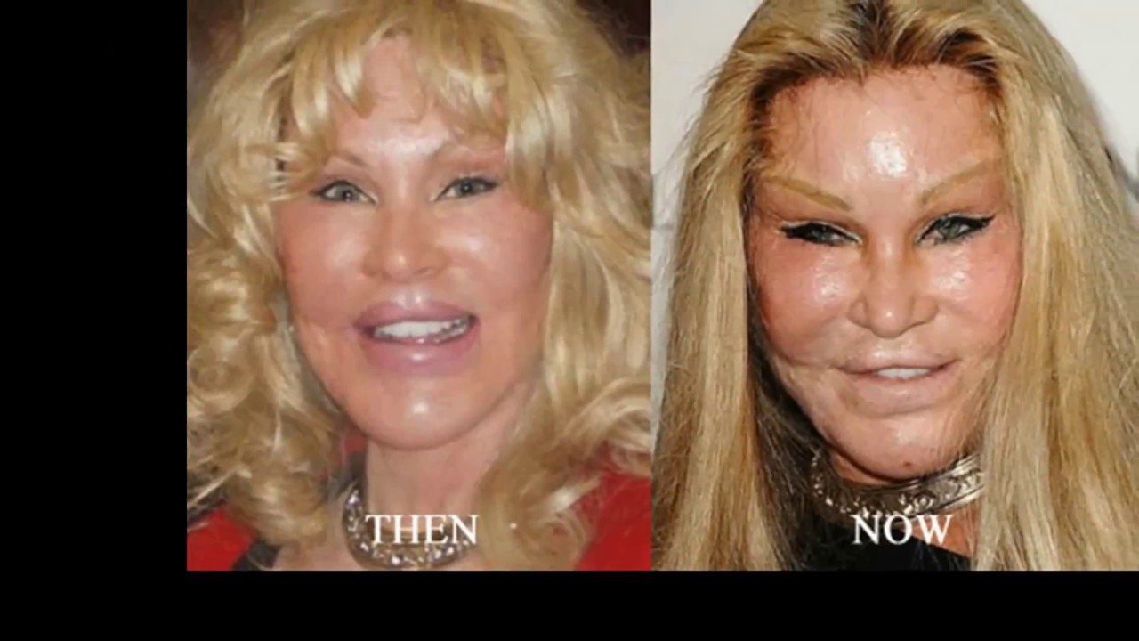 Jocelyn Wildenstein Plastic Surgery Fail Women You Won’t Believe Are
