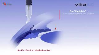 Vitra 810 De Quantel Medical - Laboratorios Retina