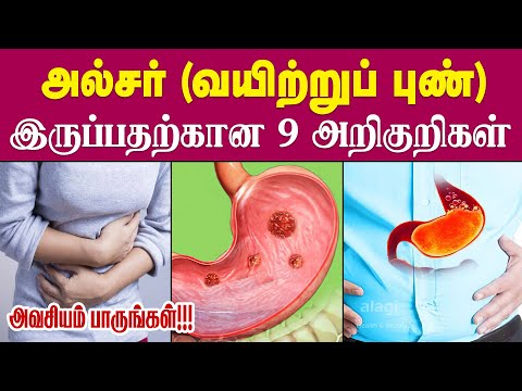 அல்சர் அறிகுறிகள் | Ulcer Symptoms in Tamil |Causes of Stomach Ulcers | Signs of Ulcer |Health Tips