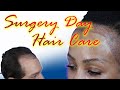 How to Wear your Hair after Hair Transplant Surgery - Steve Talks about Hair Care on Surgery Day
