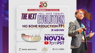 "The Next Evolution in Full Arch Therapy: No Bone Reduction FP1"
