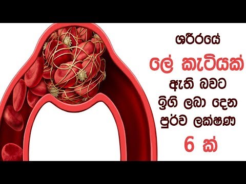 ශරීරයේ ලේ කැටියක් ඇති බවට ඉඟි ලබා දෙන පුර්ව ලක්ෂණ 6 ක්