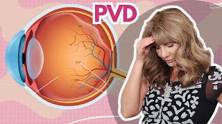 Eye Health Scare:  Finding Strength in Midlife