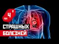 ТОП 4: Самые жуткие и страшные болезни в истории человечества