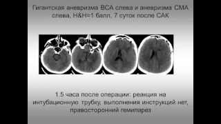 видео Классификация респираторов - это... Что такое Классификация респираторов?