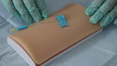 Treetops Hospice Clinical Demonstration: How to insert a subcutaneous cannula