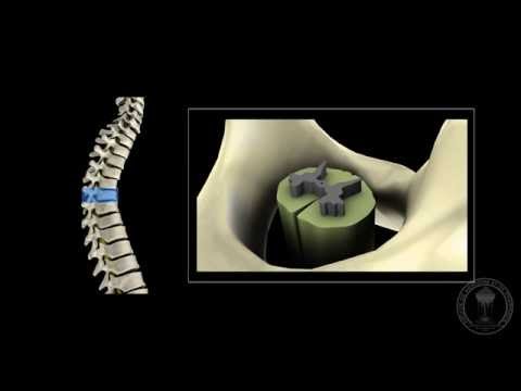 Vidéo: Différence Entre Dura Mater Du Cerveau Et De La Moelle épinière