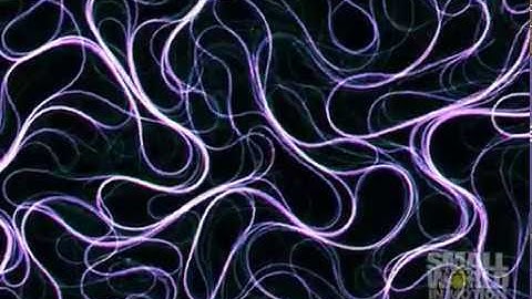 Purified Filamentous Microtubules and Kinesin Motor Proteins | 2017 Nikon Small World