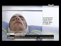 Избитому сержанту патрульной полиции Василию Марковичу необходима помощь 