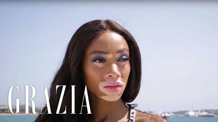 Winnie Harlow is our Big Beauty Issue cover star