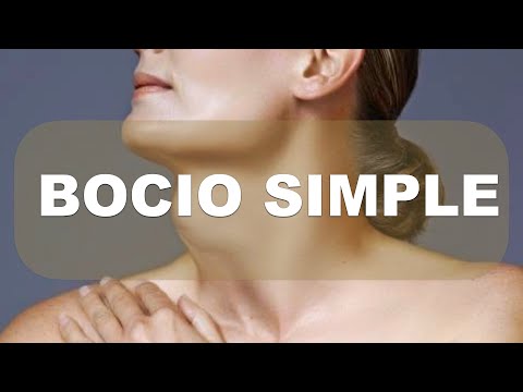 Bocio simple. Qué es. Diagnóstico. Tratamiento