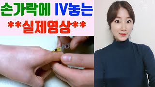 *손가락IV실제영상* 정맥주사놓는법 / iv주사놓는법 / iv 잘하는법 / 정맥주사 잘 놓는법/ 신규간호사 / 손가락 혈관주사 잘 놓는법/ intravenous injection