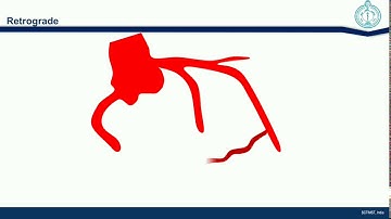 CTO wiring techniques