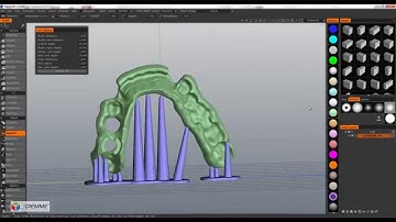 Rapid prototyping supports generation in PlastyCAD