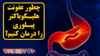 چطور عفونت هلیکوباکتر پیلوری را درمان کنیم؟