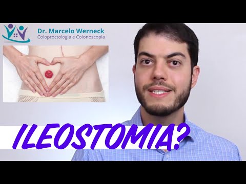 Vídeo: Onde é a incisão para ileostomia?