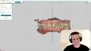 Introducing Medit Scanner Integration with Titan Dental Design