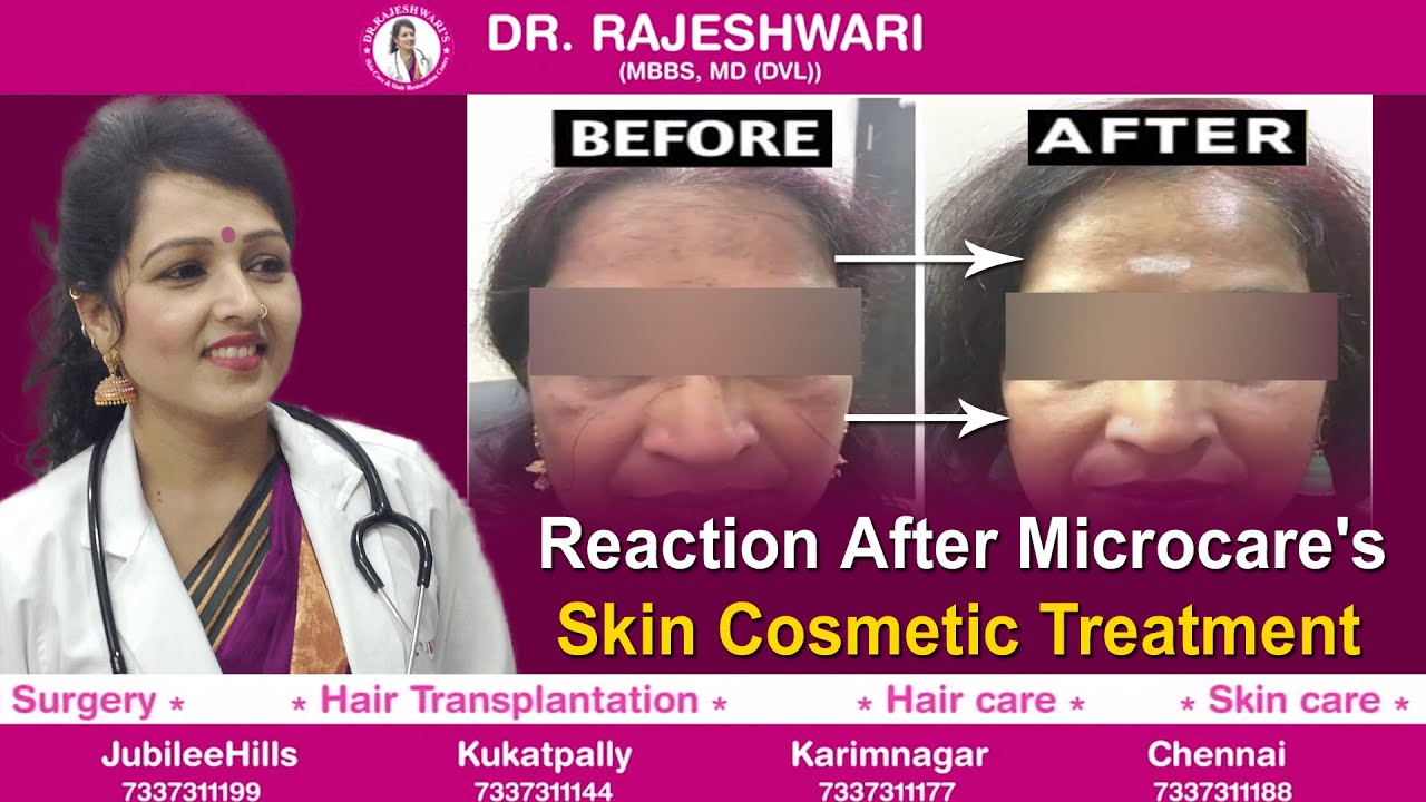 HOW TO GET SPOTLESS REDIANT SKIN with Dr Rajeshwari YouTube
