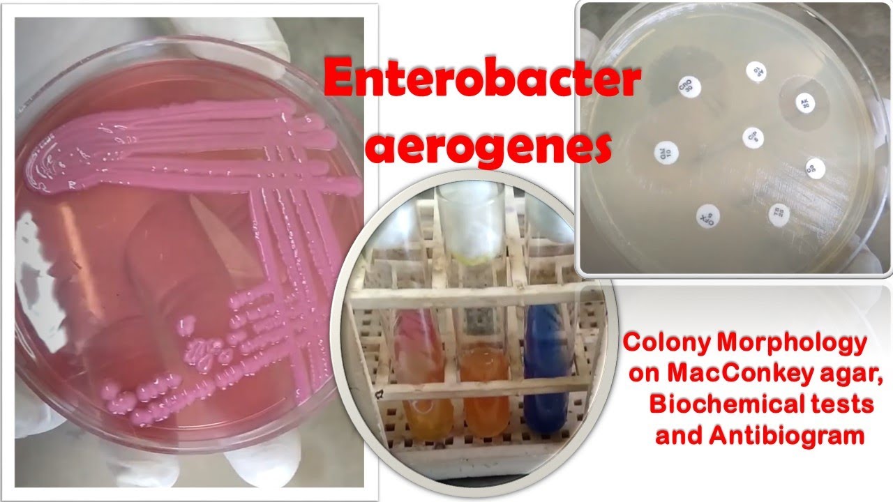 Enterobacter Aerogenes Gram Stain