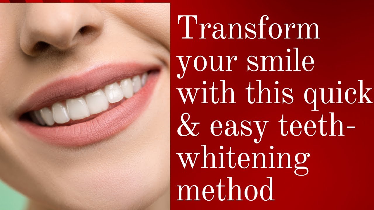 Transform Your Smile with This Quick & Easy Teeth Whitening Method