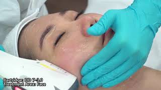 Focus Dual Operation Video