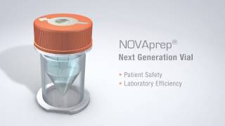 NovaPrep 1080p V2