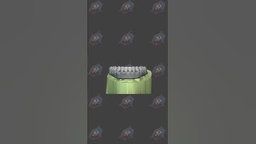 Toronto Bridge on Dentis Multi-Unit Abutments designed in Blenderfordental