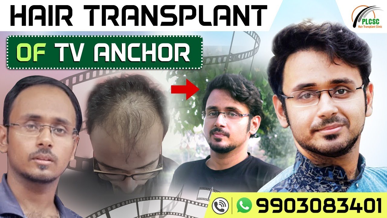 Hair Transplant In Kolkata II Best Hair Transplant Clinic In Kolkata II Hair Transplant Review