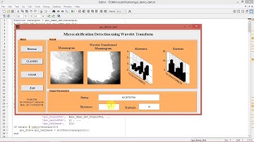 Micro Calcification Detection Using Wavelet Transform Full Matlab code Final Year Project