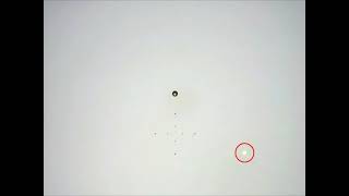 HVF (Humphrey Visual Field) Test