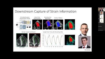 Cardiovascular AI: Development to Deployment