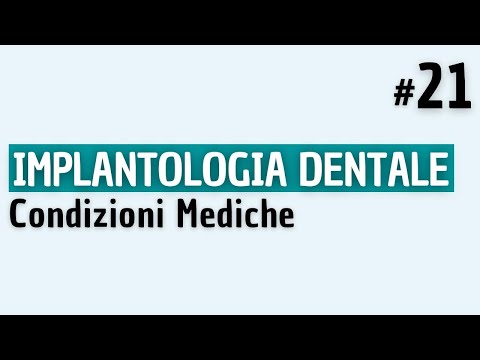 Video: Impianto Dentale - Tipi Di Impianto, Complicanze E Controindicazioni