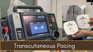 Crash Cart 04: Transcutaneous Pacing (TCP)