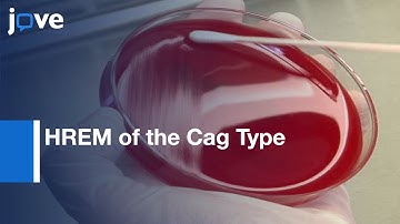 HREM of the Cag Type IV Secretion System Pili | Protocol Preview