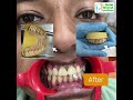 DELHI DENTAL ACADEMY