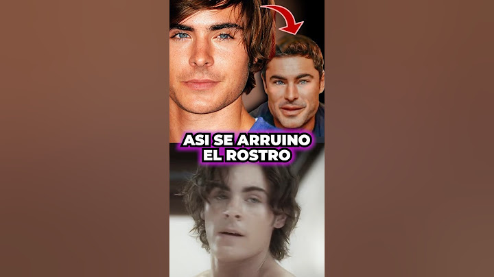 ZAC EFRON ARRUINADO POR LAS CIRUGÍAS ❌ #shorts