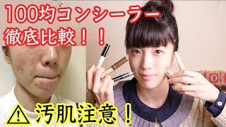 【コンシーラー】100均コスメでニキビを隠せ！【思春期ニキビ】