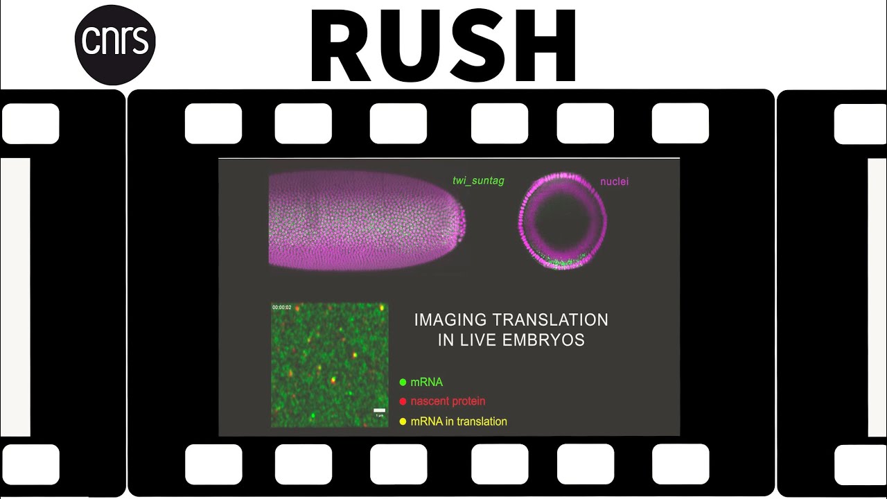 Lumire sur la traduction des ARN messagers dans un embryon  Rush de recherche