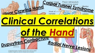 Clinical Correlations of Hand (13/14) || Upper Limb || كلية الطب - مادة التشريح || (M1---) || [58]