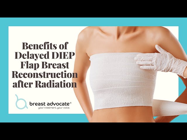 Image of delayed DIEP breast reconstruction (left breast) and