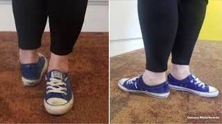 US Woman Breaks Guinness World Record for Largest Foot Rotation
